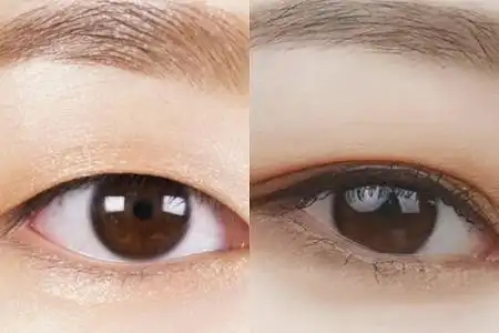 内双和单眼皮的区别图让你分分钟看出其中的缘由