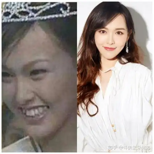 唐嫣胡歌很多人都会羡慕明星的高颜值,但大家不知道的是,有部分明星在