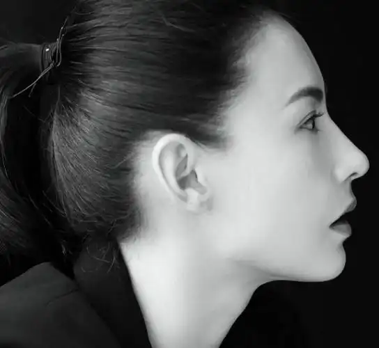 侧脸不好看怎么改善?