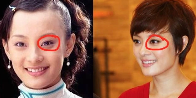孙俪整容开眼角 哪些明星整容后人气大涨
