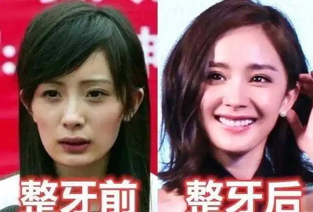 十二张女明星整容前后图片,有几个你们完全认不出来_对比_变化_网友