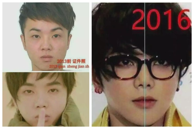 华晨宇近照再被疑整容,脸型变窄下颚骨无棱角,跟旧照差别太大?