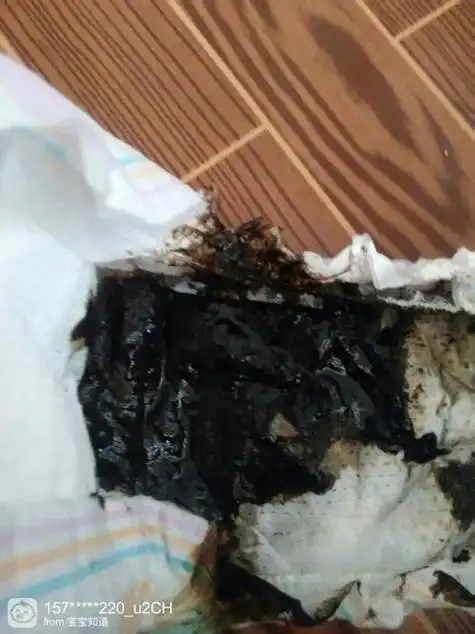 连续拉几天肚子屎是黑色的,连续几天拉肚子黑便