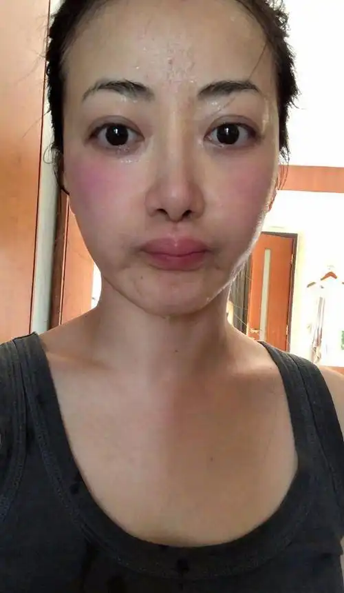 最真实的素颜照,陈紫函强调:无滤镜,无美颜,过敏状态下卸妆!