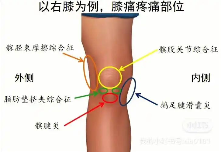 膝关节常见问题有韧带损伤,半月板损伤,内测副韧带损伤,股四头肌肌腱