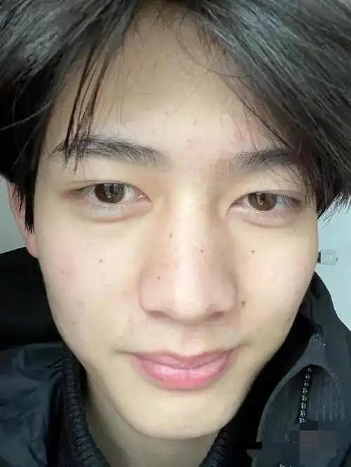 这还是男版杨超越甘望星素颜怼脸自拍瑕疵明显判若两人