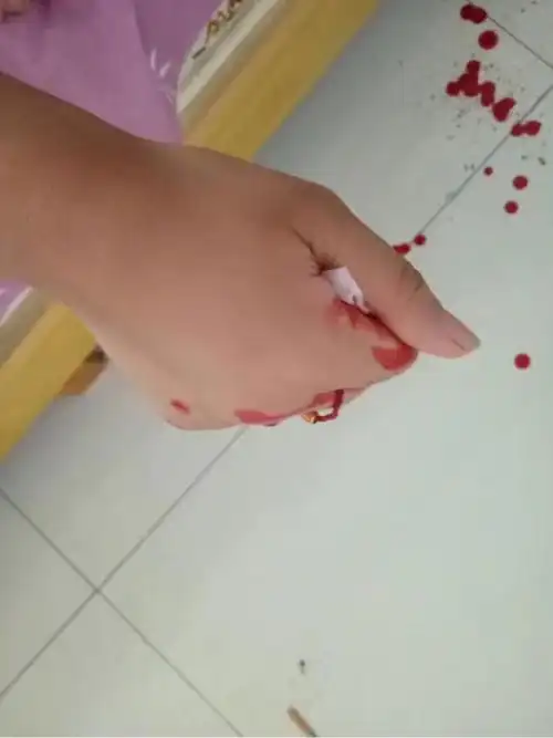 > 女在割脉…疼…有点割不下去…怎么办…有没有什么不疼的方法?