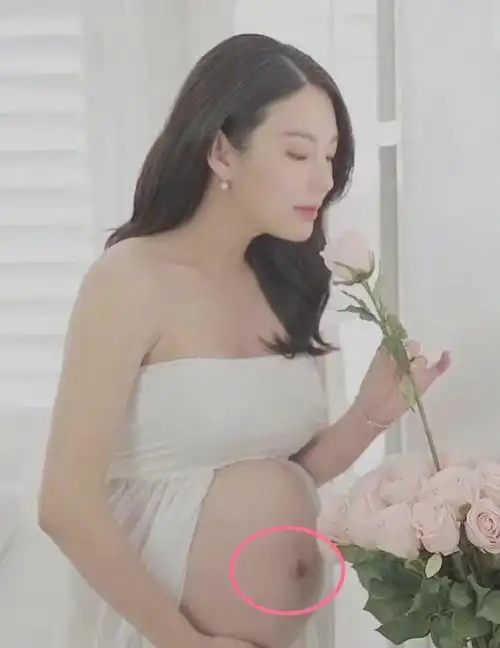 张雨绮孕肚照曝光肚大如箩四肢纤细颜霸肚脐妊娠纹明显