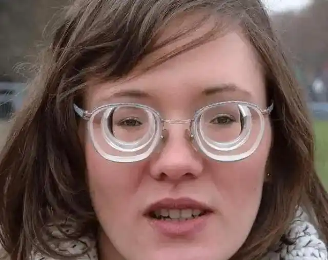 近视眼戴眼镜真的会让眼球变凸吗?_眼睛