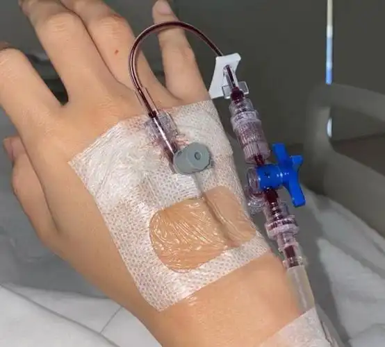 诗玛在社交网上贴出手背插着输血管的照片.