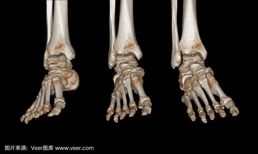 右踝关节ct扫描三维渲染图像.