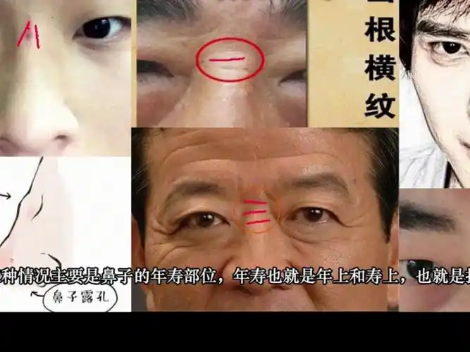 面相"鼻相"山根横纹,山根有痣,年寿起节的特征与含义