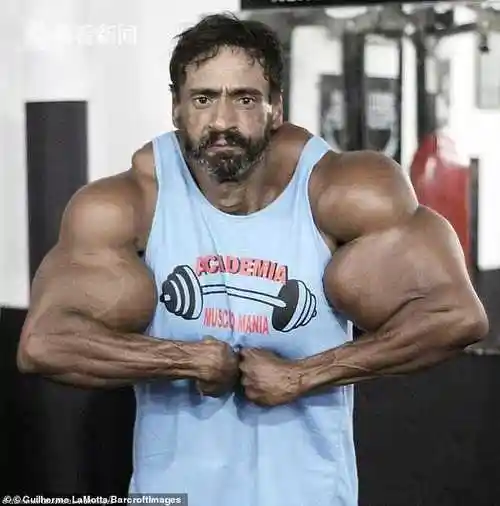 巴西男子为出名冒死注射合成物 从皮包骨变成肌肉发达的绿巨人
