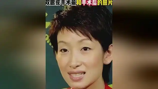 没有割双眼皮的秦海璐,和手术后的对比照片,气质有明显改善|曲风/爵士