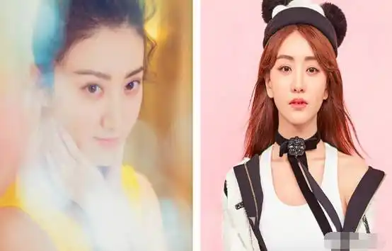 景甜,杨蓉砸几十亿也红不了,因为她们脸上有两大致命缺陷?