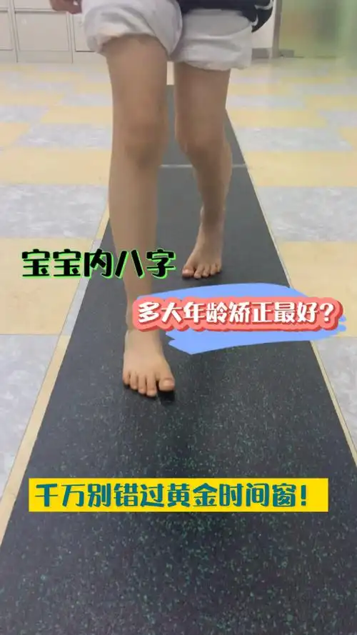 育儿宝宝走路内八字是什么样子多大年龄矫正最好骨科医生建议千万别