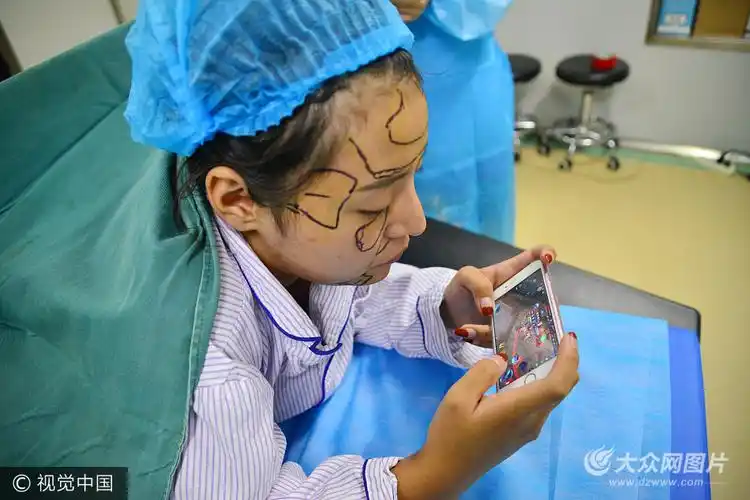 济南98后女孩边玩游戏边直播整形手术