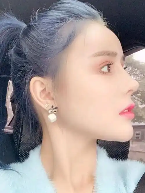 角度最能展示鼻子的美丽94,无疑肯定是侧面的_圈子-新氧美容整形