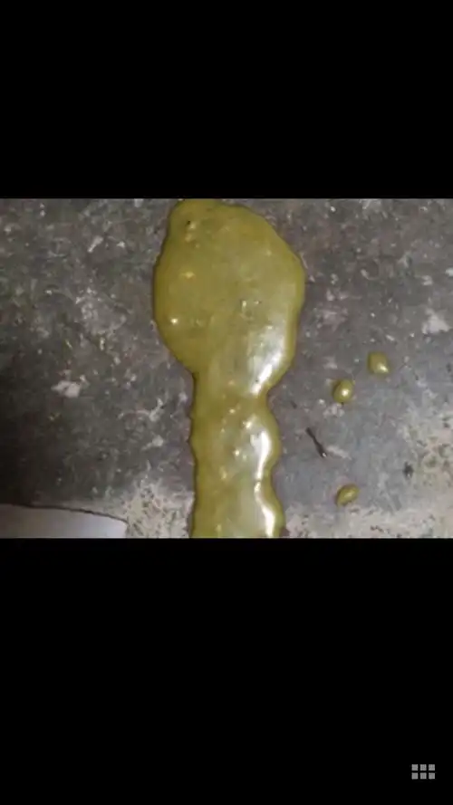 四个月宝宝每两天拉一次灰黑色大便 正常吗?