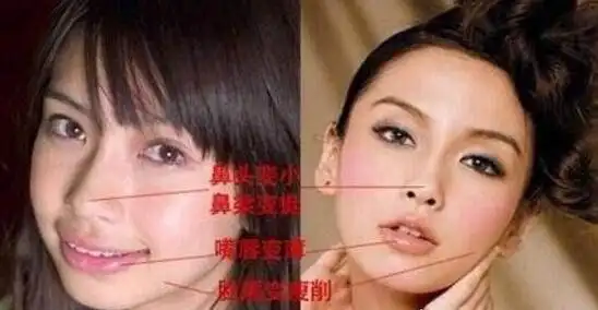 angelababy杨颖整容前后照片对比黄晓明都认不出2