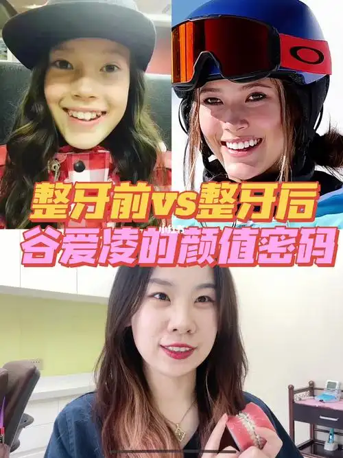 为首的隐形牙套这几年在国内大97主要优点是[一r]近乎隐形73无