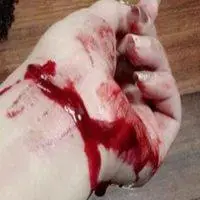 割脉自杀的图片超真实