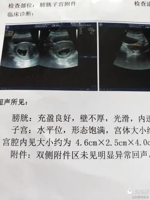 听朋友说的,孕早期的孕囊形状,长形的是男孩,圆形的_妈妈网孕育社区