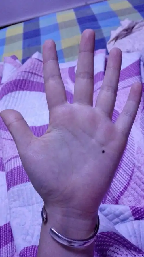手掌这个位置长痣啥意思,别把百度里的复制给我.谢谢