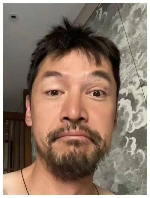 胡歌状态堪忧!晒照胡须伤疤,心情低落悲观._生活_微博_车祸