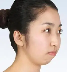 短下巴的人命运到底怎么样