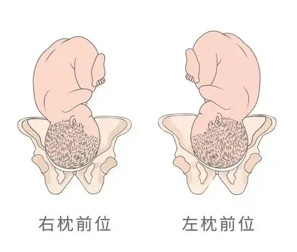 枕前位又分为左枕前位和右枕前位,左枕前位相对比较常见,如果在 32 孕