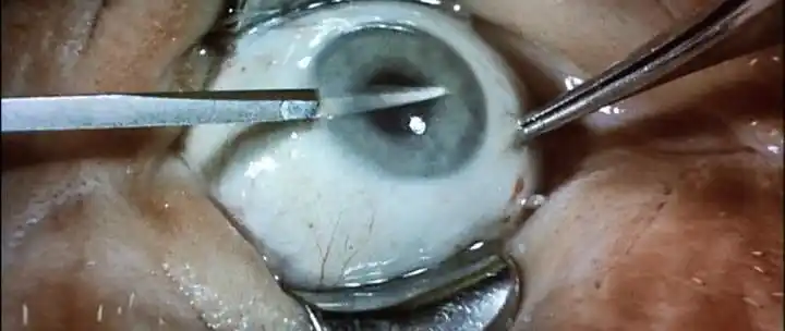 凶眼有个妈宝男喜欢在电影院挖人眼珠