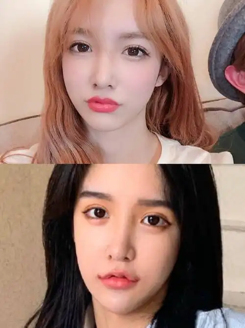 过度整容的脸会崩成什么样?