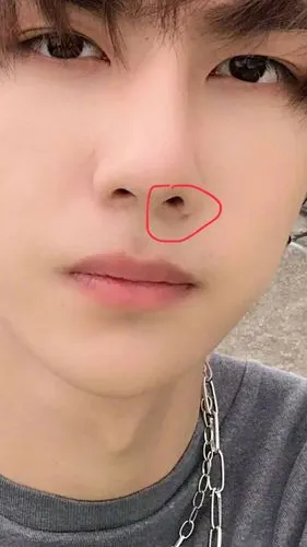 王一博疑似整容痕迹明显