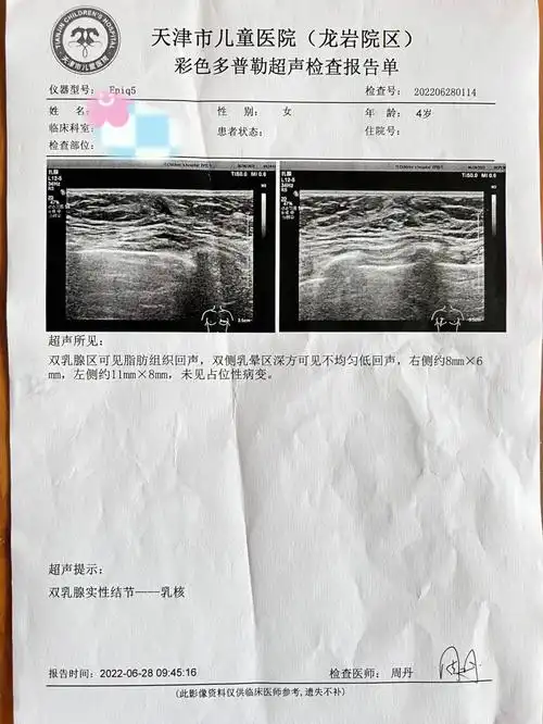 5岁乳房发育早熟 求治疗方案