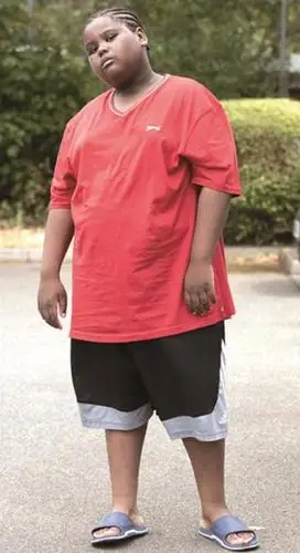 10岁的凯恩·弗里茨·马里奥特则被称为现在英国最肥胖的小学生,他