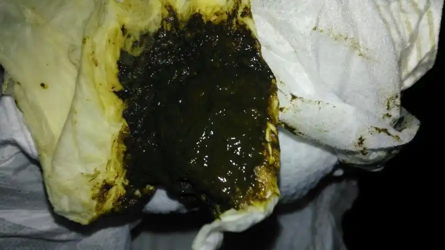 宝宝出生第六天了,拉的便便还是褐色