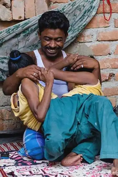 连体姐妹共侍一夫产下一子 揭秘全球连体人的神奇生活