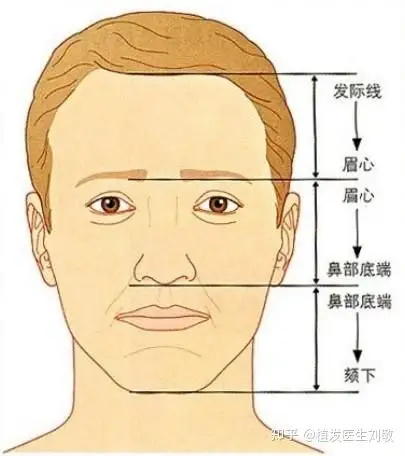 发际线是不是好高了?
