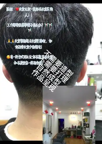 原创头发掉比较 软如何让头发变的更多 我想变的更年轻