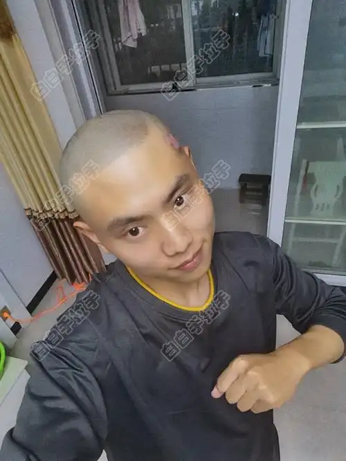 论坛 69 白癜风健康专区 69 心情驿站&情感 69 七天一光头!