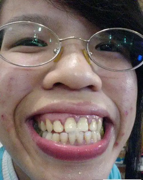 网络丑女排行榜top20 凤姐名列第六