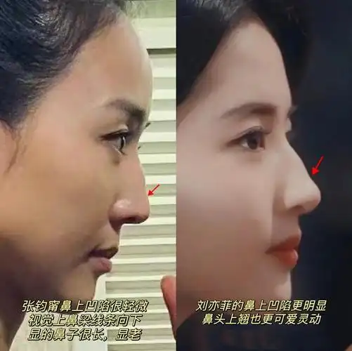 受"天仙"刘亦菲影响,近几年驼峰鼻似乎越来越流行.