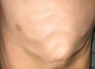 缤纷!鸡胸和正常人区别图片"天下无双"-第1张图片-星空博客