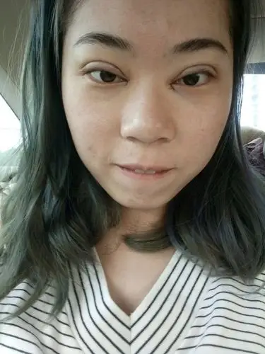 割完双眼皮,简直就是改变了我的人生