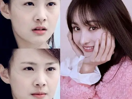 这些明星缩小完鼻翼,令人窒息