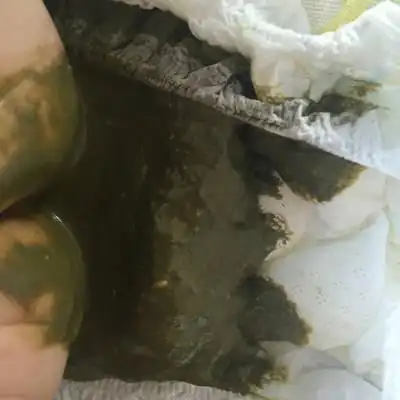 三个半月宝宝要三,四天大便,颜色深绿的