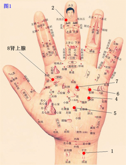 主富贵左手手掌小鱼际有痣者管理他人,如果管不好容易给人小鞋穿,而