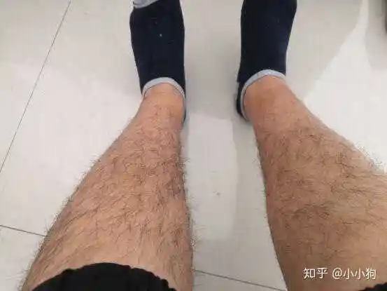 20多年了,以前从来没想过这问题,还以为腿毛重视男人的本性,是男人的