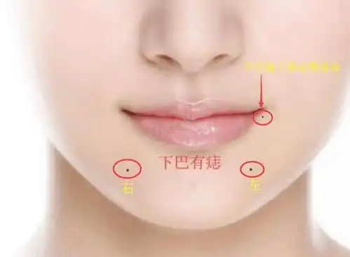 下巴上的痣都有什么寓意呢下面我们来看看